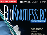 BioKnotless RC