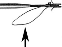 Metal Knotless